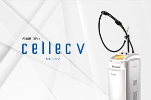 セレックV