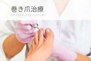 巻き爪治療