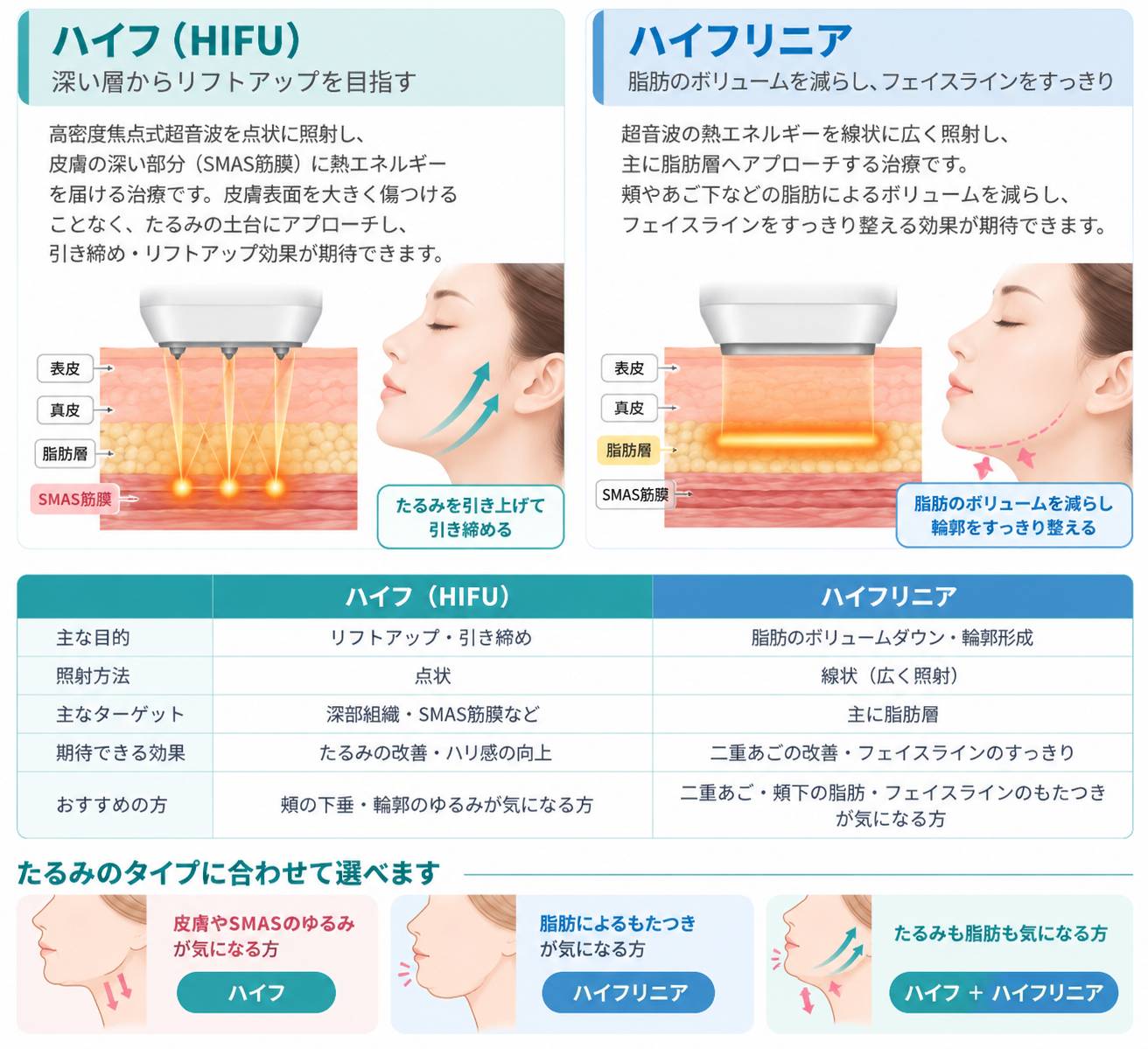 ハイフ（HIFU）とハイフリニアの違い：照射方法・主なターゲット・期待できる効果の比較と、たるみのタイプ別の選び方